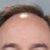 Profile picture of Pierre Dorions Bald Spot